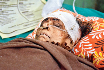 বৃদ্ধাকে কুপিয়ে লুঠপাট বগুলায়