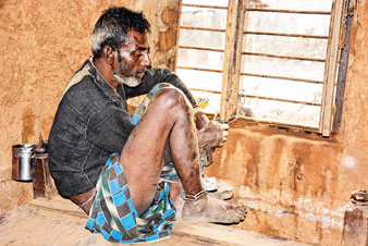 অভাবে বন্ধ চিকিত্‌সা, পায়ে শিকল