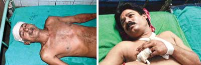 দা-কাটারি নিয়ে মারপিট আমানতকারী-এজেন্টের