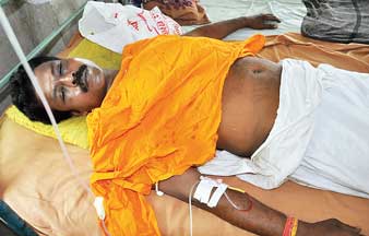 বিজেপি নেতাকে রড-চেন দিয়ে মারধর চন্দননগরে