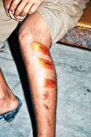 হোমে ছাত্রকে মারধর কালনায়