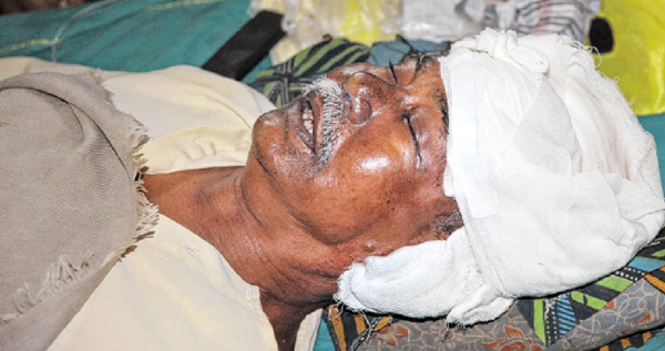 রবিবার সিউড়ি হাসপাতালে চিকিৎসাধীন ধীরেন লেটের ছবিটি তুলেছেন তাপস বন্দ্যোপাধ্যায়।