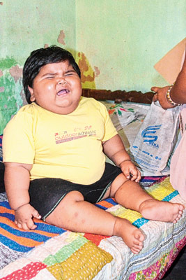 poor parents of Twenty four month old alia’s abnormal over weight
