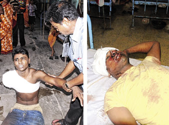 Two brothers injured at Malda