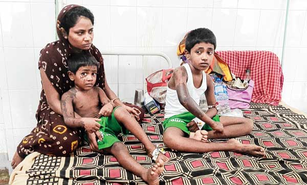 মা-ছেলের গায়ে অ্যাসিড ছুড়ে পলাতক গৃহকর্তা