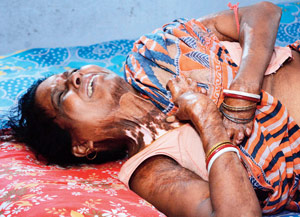 clash for making local drainage system injured handicapped woman at baksara howrah