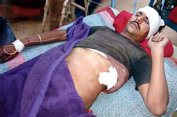 দু’জনের বচসা থামাতে গিয়ে ছুরিবিদ্ধ