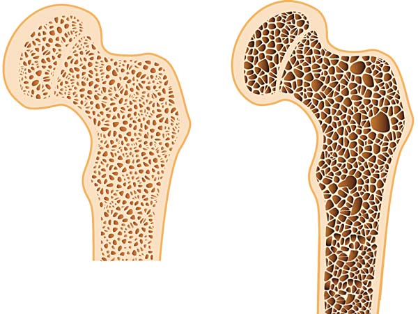 one cup of curd to protect women bone