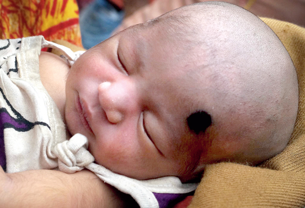 New Born infant rescued 