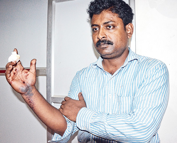 Miscreants shoot a businessman on his way to home