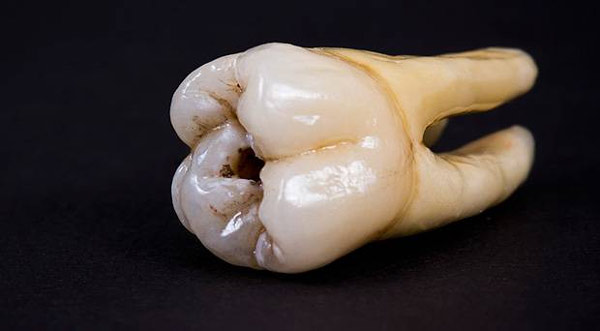 IB of lalbazar will investigate on 53 tooth found from different places of the city