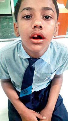 School boy injured in a car accident at Diamond Harbour Road