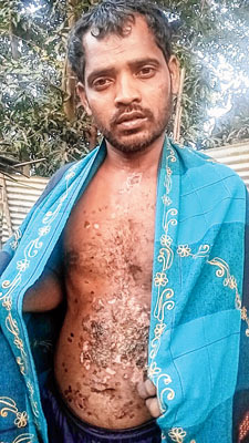 Man was tortured brutally for allegedly witchcraft