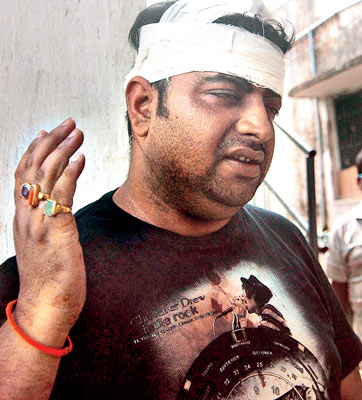 Businessman being knocked down by Toto-Driver