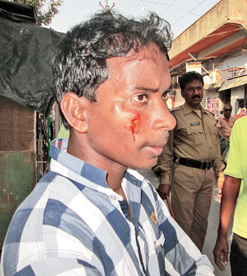 TMCP group clash in Kalna College