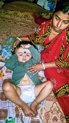 মাথা-বড় ছেলেকে নিয়ে চিকিৎসার প্রতীক্ষায় মা