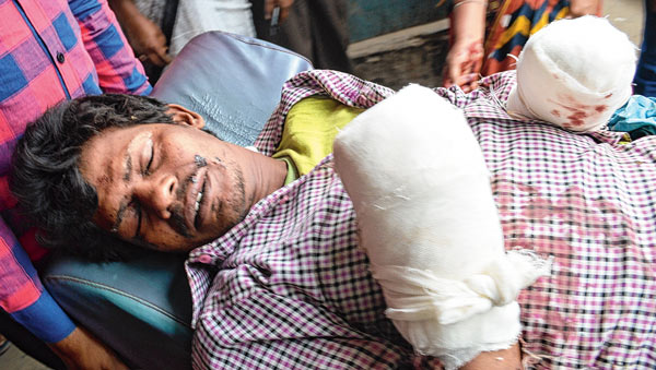 Tmc leader's son lost his hand in exposion due to bomb binding