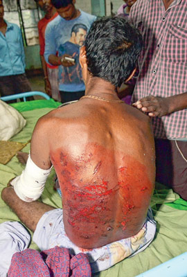 Explosion injured two people