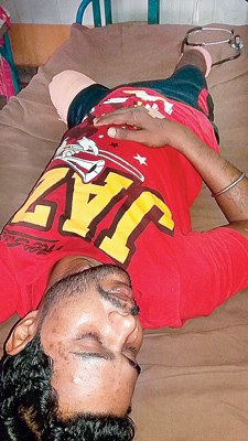 TMC leader admitted in hospital for attempt of Suicide for 2nd time 