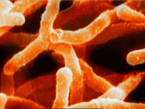 Microbes in Space: Indian Researcher Explores Tiny Life-dgtl