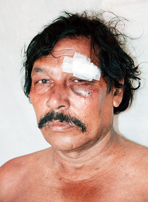 Again conflict in mangalkot regarding a construction of roads