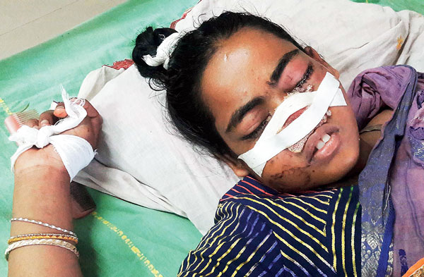 Husband gets jail by biting wife