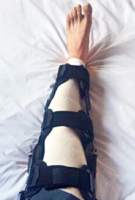 Sachin Tendulkar undergoes knee surgery in London