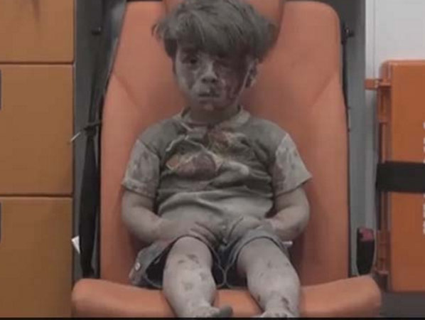 The Stunned, Bloodied Face Of A Child Survivor Sums Up The Horror Of Aleppo-dgtl