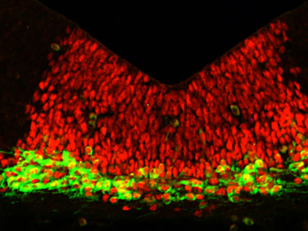 Scientists grow mini human brains-dgtl