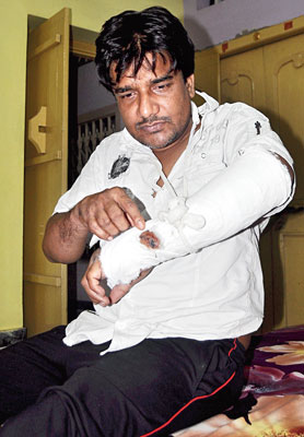 Toto driver accused for severely injuring passenger