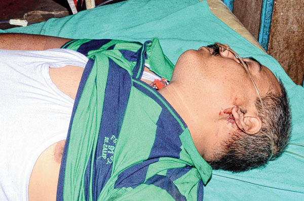 5 injured due to fighting for tangle lands  