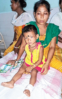 Mother saves child inspite of miscreants attack 