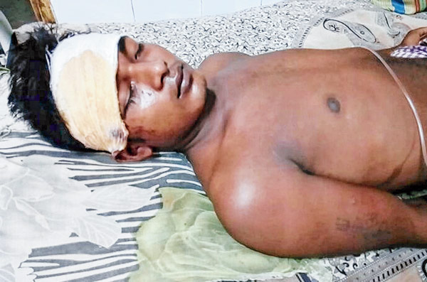 Youth affected to protest against alcohol