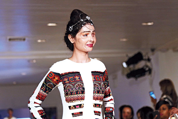 Acid attack victim walks in New York week 