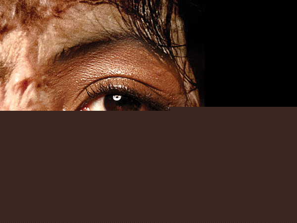 Accused acid attackers released on bail