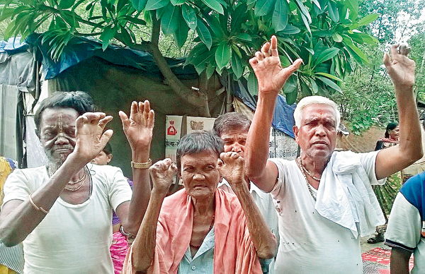 People of Leprosy colony are deprived of rationing systen