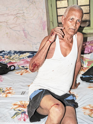 Senior's money looted by miscreants