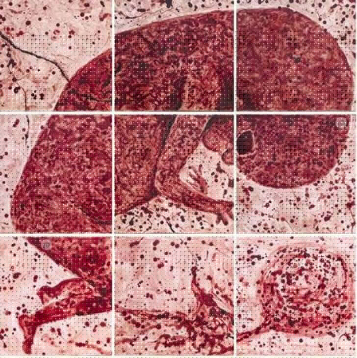 সম্পূর্ণ ছবি।