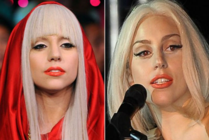 এথনো প্লাস্টিক সার্জারি: <br> 
রাশিয়ায় এই ধরনের সার্জারি এখন খুবই জনপ্রিয়। প্লাস্টিক সার্জেন ওটারি গোগিবেরিটজ জানাচ্ছেন, ‘‘অনেকেই এখন <br> উরোপীয়দের মতো ‘লুকস’ পেতে চাইছেন। এই সার্জারিই আসলে এথনো ব্লেফারোপ্লাস্টি <br> সার্জারি। প্রধানত নাক ও চোখের অস্ত্রোপচার করা হয় এই ধরনের প্লাস্টিক সার্জারিতে।’’