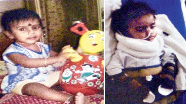 18 month old baby paralysed due to Medical Negligence