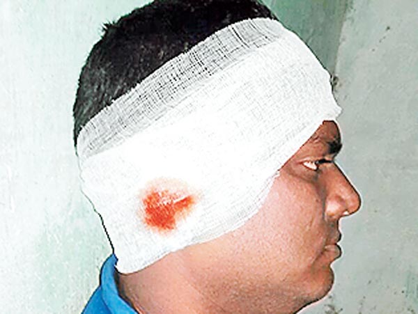 TMCP group clash in College, wounded eight