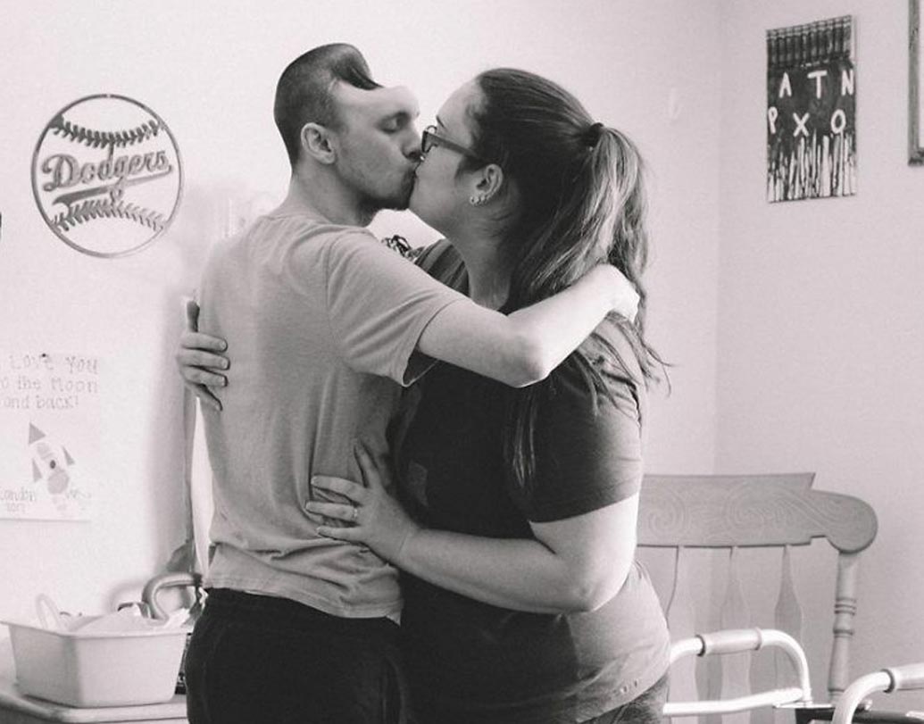 কিন্তু এই একবারের অস্ত্রোপচার অস্টিনকে সুস্থ করে তোলার জন্য যথেষ্ট ছিল না। একাধিকবার তাঁর অস্ত্রোপচার করতে হয়। বাদ দিতে হয় খুলির অনেকটা।