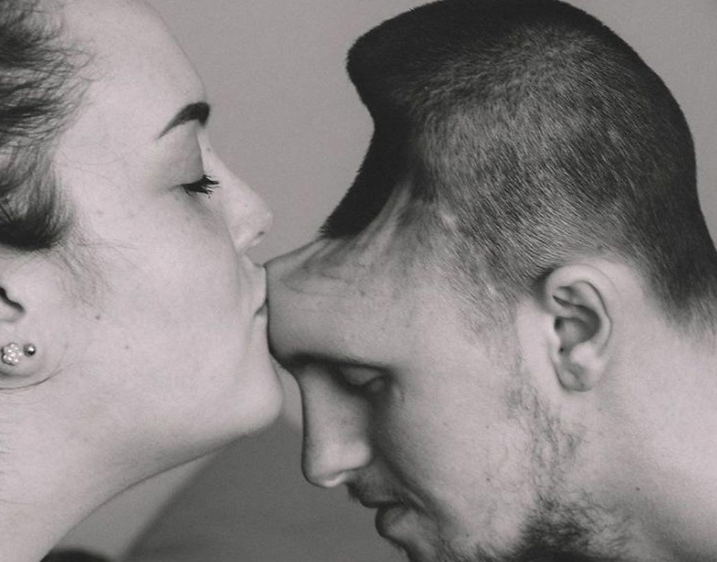 ইতিমধ্যে হাসপাতালে সন্তানের জন্ম দেন ব্রিয়ানা। সন্তানের জন্মের দু’মাস পর হাসপাতাল থেকে বাড়ি ফেরেন অস্টিন। আর তার পরই যেন মিরাকল ঘটে যায়। সন্তানকে দেখার পর থেকেই আস্তে আস্তে অনেকটাই সুস্থ হতে শুরু করেন। এখন তিনি ব্রিয়ানার হাত ধরে উঠে দাঁড়ান। নিজে খেতে পারেন। আস্তে আস্তে হাঁটাচলাও করতে পারেন। তবে মাথাটা এখনও ওভাবেই রয়েছে তাঁর।