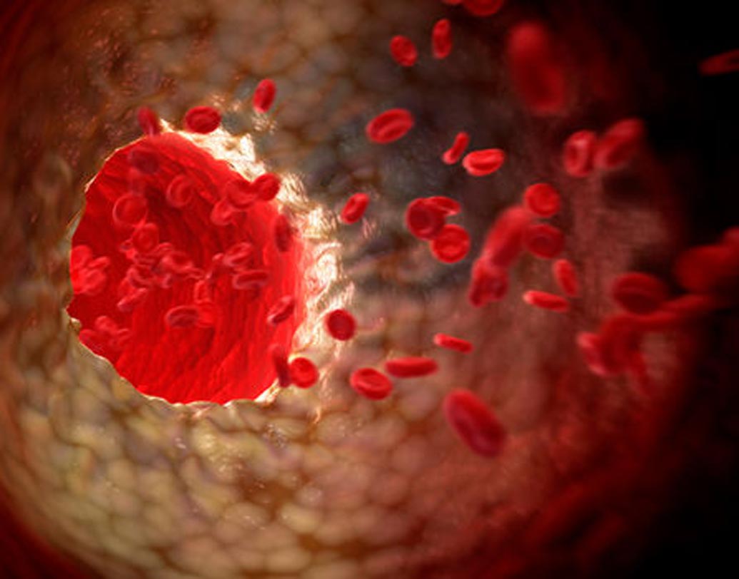 যাদের রক্তে কোলেস্টেরলের পরিমাণ স্বাভাবিকের তুলনায় বেশি তাদেরও স্ট্রোকের সম্ভাবনা বেশি। (২৭%)