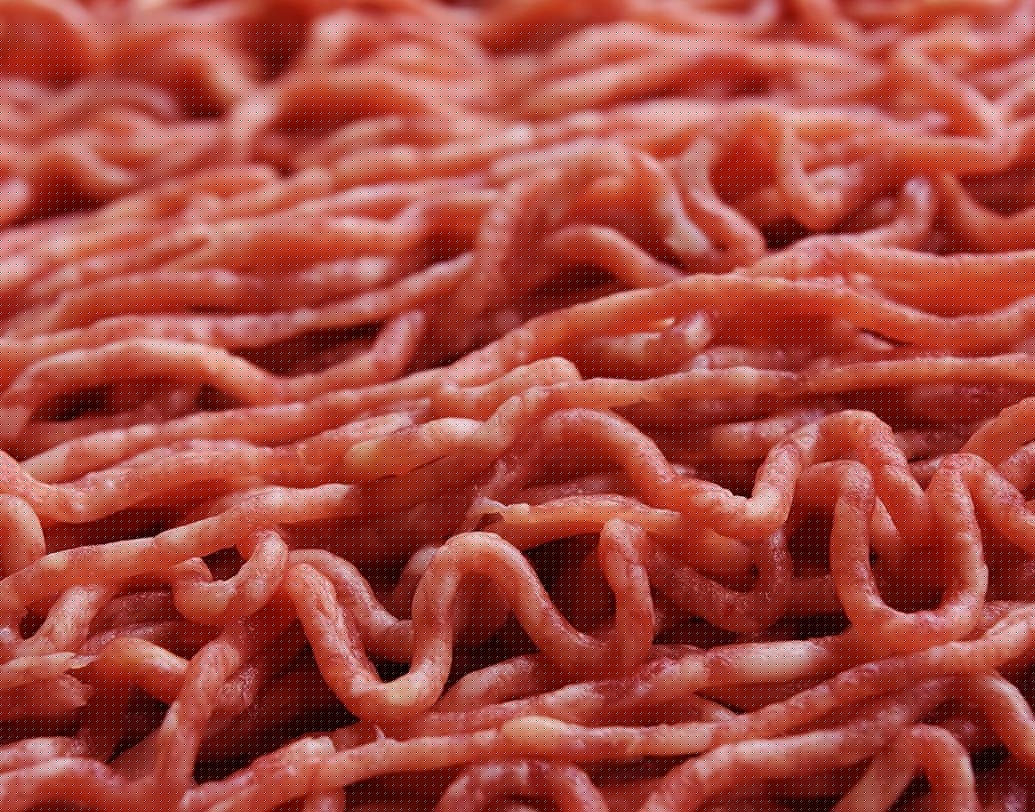 টিনিয়া সোলিয়াম: টিনিয়া সোলিয়াম কৃমির বাহক শুয়োর। ইনফেকটেড শুয়োরের মাংস খেলে রক্তে অন্ত্রে টিনিয়া সোলিয়াম অ্যাটাক করে। যা রক্তে চলে এসে মৃত্যু পর্যন্ত হতে পারে।