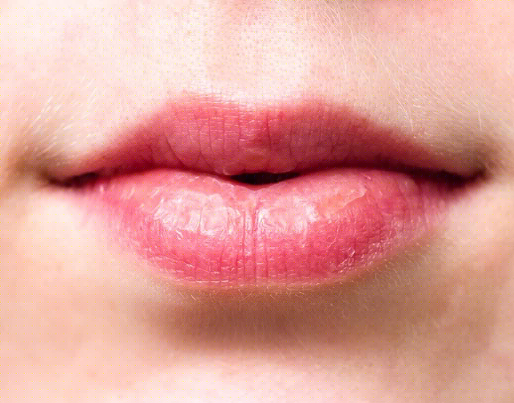 যাদের ঠোঁট লাল হয় তারা খুবই রাগী হন। নতুন কিছু শেখার ব্যাপারে উত্সাহ থাকে। রাগ নিয়ন্ত্রণে রাখতে সমস্যা হয় এদের।