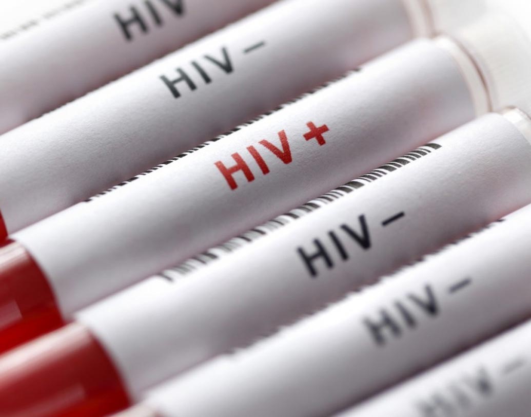 এইচআইভি টেস্ট নেগেটিভ এলে কন্ডোম ব্যবহারের প্রয়োজন নেই: সদ্য এইচআইভি-তে আক্রান্ত হলে তা পরীক্ষায় ধরা পড়ে না। অন্তত তিন মাস লাগে ধরা পড়তে। তাই এইচআইভি নেগেটিভ মানেই কন্ডোম ব্যবহারের প্রয়োজন নেই তার কোনও মানে নেই।