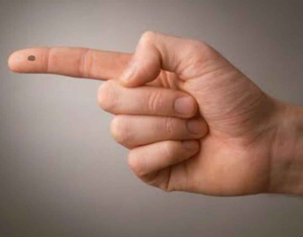 তর্জনীতে তিল:তর্জনীতে তিল থাকলে টাকা পয়সা সংক্রান্ত সমস্যায় সারা জীবন ভুগতে হতে পারে আপনাকে।