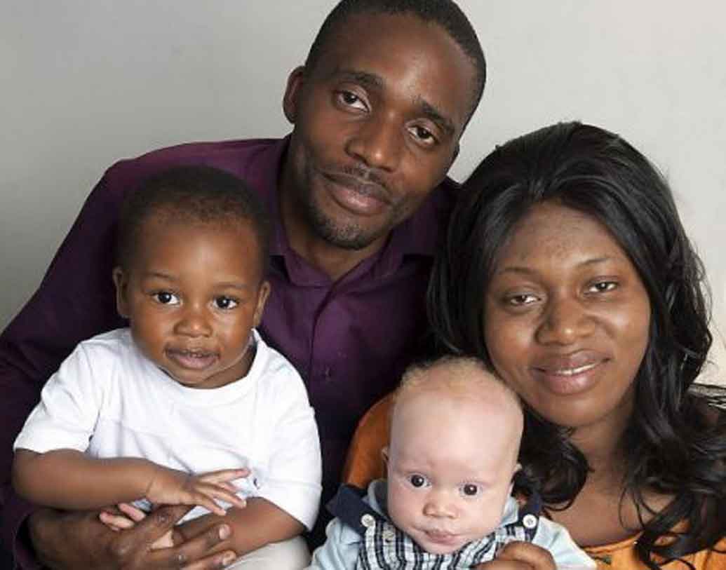 ড্যানিয়েলের জন্মের পরই এমন ‘মিরাক্যাল’ দেখে চমকে ওঠেন ওই দম্পতি। অবাক চিকিৎসকরাও। কারণ কৃষ্ণাঙ্গ পরিবারে এমন ঘটনা এই প্রথম। ধবধবে সাদা চামড়া আর সোনালী চুল নিয়ে জন্মেছে ড্যানিয়েল।