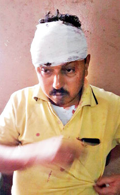 2 Men comes for help for the Man faces Accident